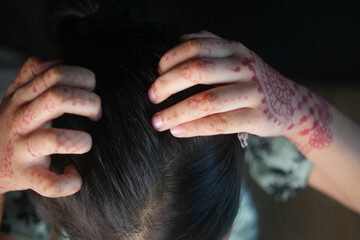 Obraz premium little girl Scratching her Head