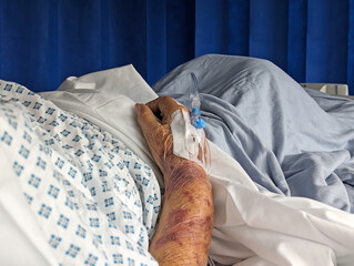 Cropped view of an elderly lady lying in a hospital bed with a cannula in a bruised arm