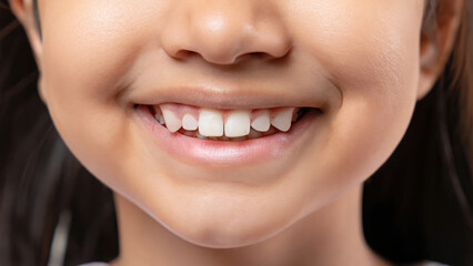 Obraz premium close up on perfect teeth opf a child, kid with perfect dental care, lips of a baby