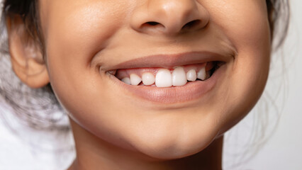 Fototapeta premium close up on perfect teeth opf a child, kid with perfect dental care, lips of a baby