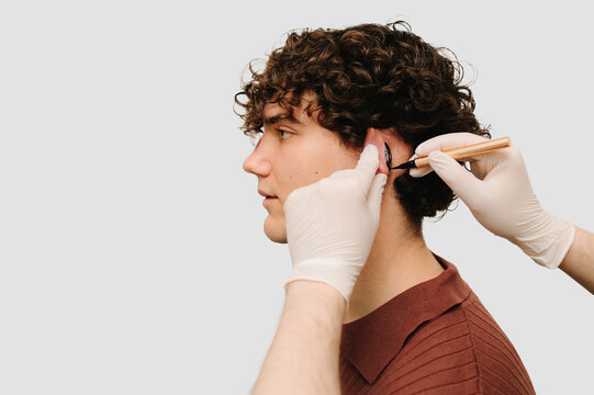 Otoplasty surgery markup ear. The doctor drawing mark up lines before plastic surgery for reshaping ears.