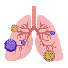 Lungs infection, viral pneumonia medical disease illustration 