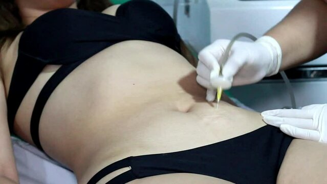 est&eacute;tica, procedimientos en el abdomen. cl&iacute;nica de belleza. aplicaci&oacute;n de ozono, terapia de ozono, enzimas, adelgazamiento. p&eacute;rdida de peso.