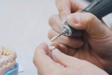 Person Cutting Tooth With Scissors