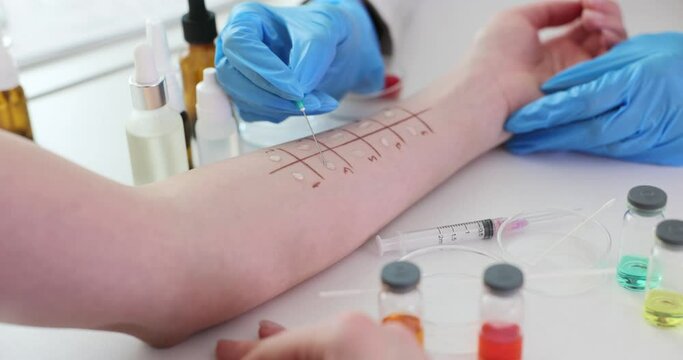 Skin prick test for allergies on patient arm