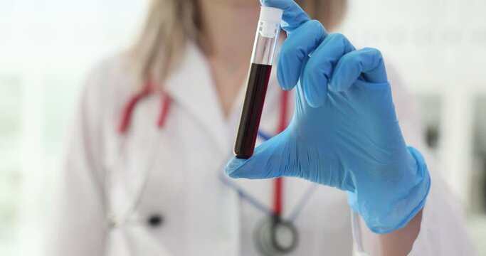 Doctor scientist holds and looks at blood sample in tube