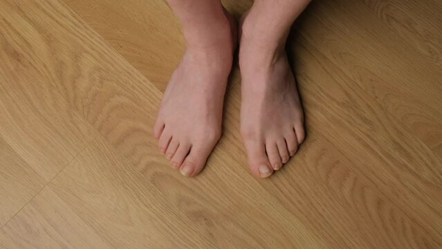 Close-up of a woman's feet with hallux valgus.