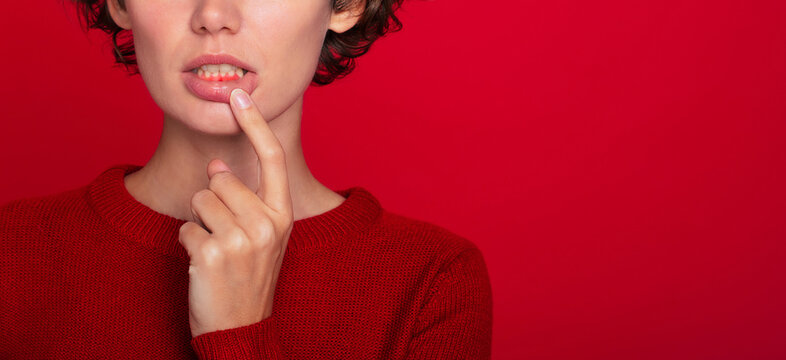 Treatment of oral disease. Banner cropped shot of a young woman showing red bleeding gums isolated on a bright red background. Dentistry, dental care, gum inflammation.