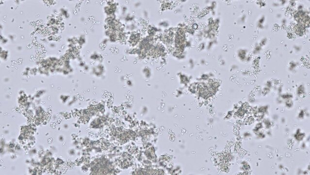 kefir (fermented milk, with yeasts and kefir grains) under the microscope - optical microscope x400 magnification - probiotics, dairy products and fermented foods concept