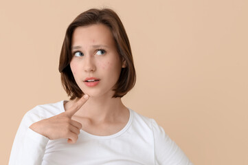 Beautiful young thoughtful woman with acne problem on beige background