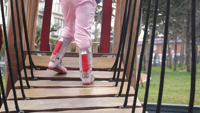 A little girl in orthosis shoes crosses a wooden bridge Child cerebral palsy disability.