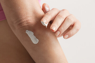 Woman applying elbow cream. Beauty and body care. Winterizing dry itchy skin on the elbow area.	