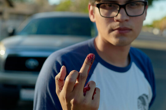 A man is holding up his injured finger, which is bleeding, with a concerned expression on his face; there is a blurry background with a vehicle.