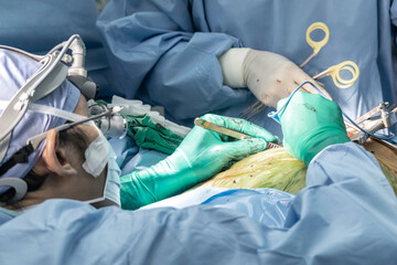 Close-up of a doctor performing heart surgery on a patient in the operating room. Portrait doctor of surgeons in Surgery operating room.