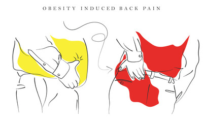 Hand drawn line art vector of Obesity induced Lower back pain