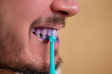 A man with blue teeth looks amused in a closeup shot, with a spontaneous and vibrant expression...