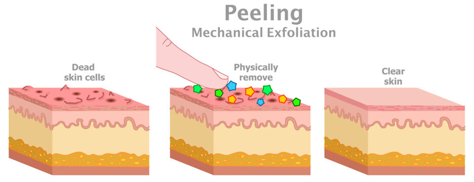 Peeling, mechanical exfoliation. Physically scrub with finger, brush. Clean skin care, old dead cells. Before, after products. Human facial fillers skincare Illustration vector