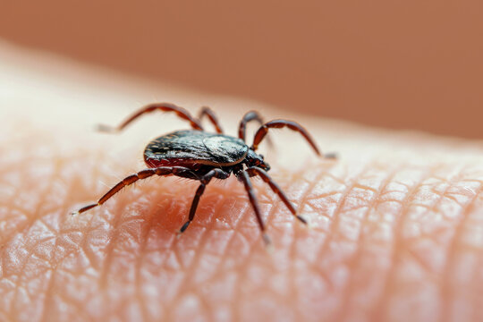 Tick on human body background, scary insect on skin, close up of danger ixodes mite on hand. Theme of animal, bite, encephalitis, health, disease