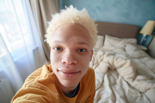 Realistic phone selfie made by an african american albino guy at home without filters