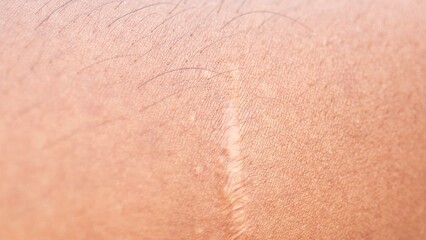 Fototapeta premium close up of a skin