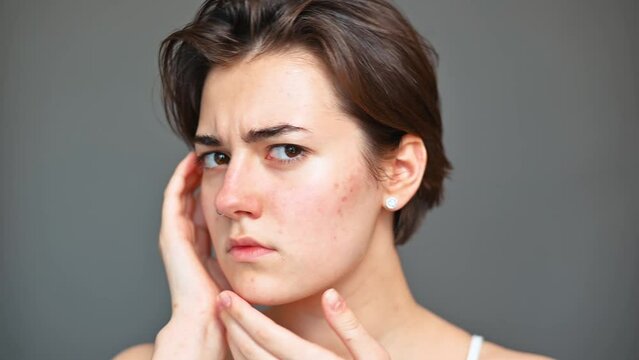 Young woman examining skin problems, close-up of face. Dermatology, skin disease irritation, acne