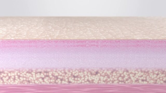 Wrinkled skin before and smooth skin after anti-aging wrinkle reduction treatment. Action of hyaluronic acid serum or injections, collagen peptides, laser therapy, beauty injections, EMS, RF facelift