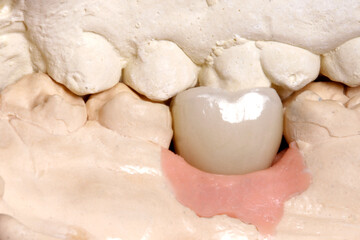  digital laboratory dentist prosthesis