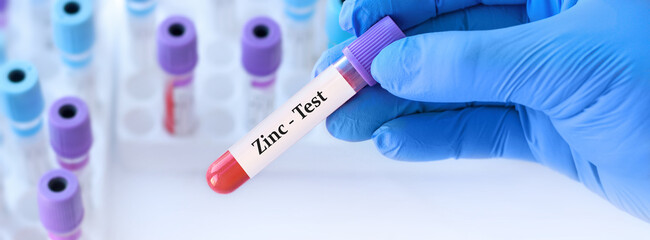 Fototapeta premium Doctor holding a test blood sample tube with Zinc (Zn) test on the background of medical test tubes with analyzes. Banner