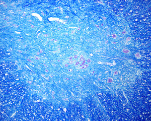 Spinal cord. Ventral horn. Motor neurons