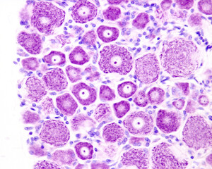 Dorsal root ganglion neurons. Nissl bodies