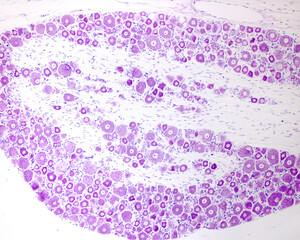 Dorsal root ganglion