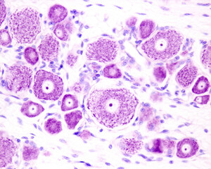 Dorsal root ganglion neurons. Nissl bodies