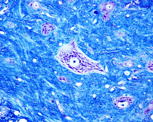Spinal cord. Motor neurons