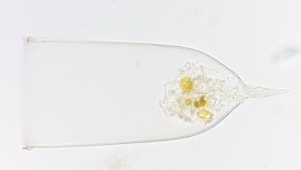 Favella sp., a marine tintinnid ciliate. Live cell. Selective focus image