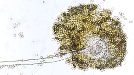 Mold species (Aspergillus sp) under microscope. Fresh sample whithout staining. Stacked image