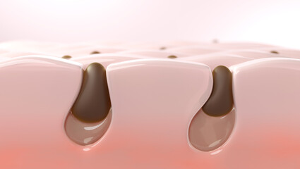 Blackhead clogged in pores, Acne treatment concept.