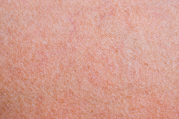 Beautiful abstract close-up human skin background texture
