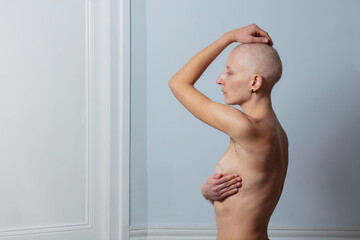Nude woman after operation hold her breast with mastectomy scar