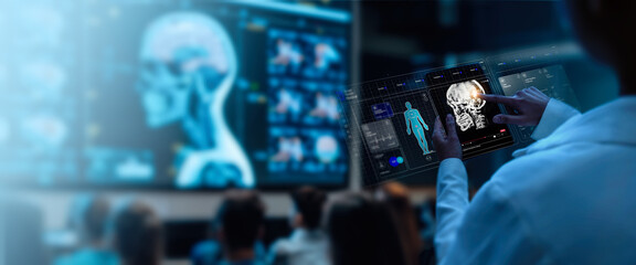 A group of medical professionals reviewing and analyzing detailed brain scans displayed on digital screens and tablets, highlighting advanced AI medical imaging technology.