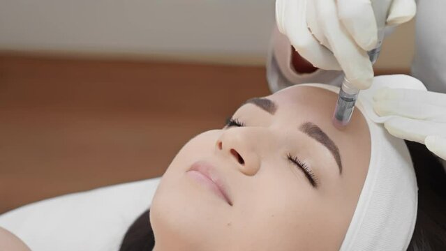 A woman receiving a facial microneedling treatment at a beauty clinic, ensuring professional skincare and skin rejuvenation with cosmetic procedures for improved skin health and a youthful glow