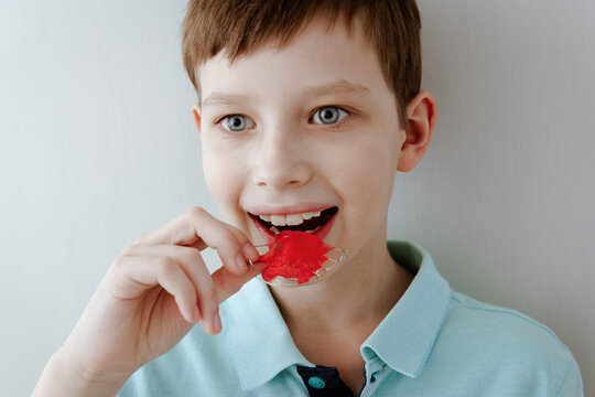 Smiling little child boy holds metal bright and colorful plate for align the teeth and bite. Orthodontist treats teeth