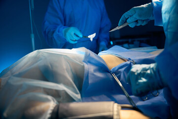 Surgeons performing surgical operation in modern operating room