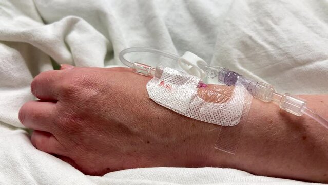 Intravenous catheter placed into wrist in hospital bed 4k