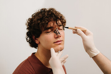 Obraz premium Process of preparation for eyelid surgery. Male rhinoplasty and blepharoplasty markup close up.