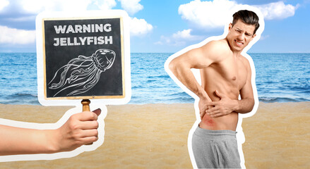 Beware of jellyfish. Injured man, woman holding small chalkboard on beach, banner design © New Africa