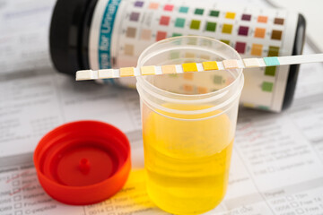 Urinalysis, urine cup with reagent strip pH paper test and comparison chart in laboratory.