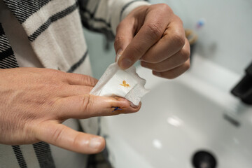 Anonymous man reveals freshly stitched wound while removing medical dressing post finger tendon...