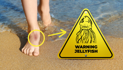 Jellyfish warning sign and injured woman on beach. Banner design
