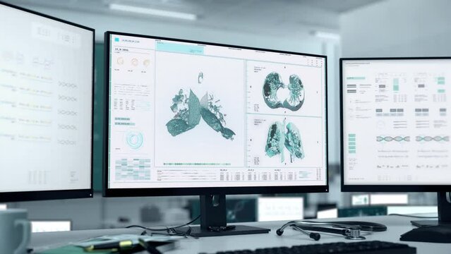 Examining the patient lungs for diagnosis at the Medical clinic. Analysing the patients lungs for illness diagnosis..Diagnosing the irreversible lung cancer disease in the sick patient.
