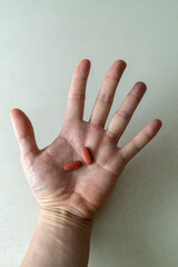 Pill on human hand medical concept